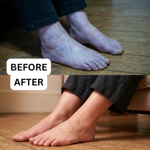 Virellaflow Microcirculation Recovery System - old