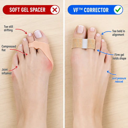 VF™ bunion corrector